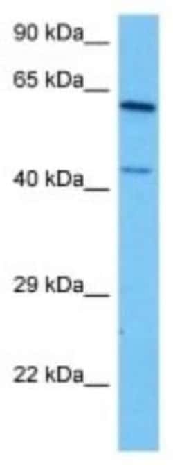 Cytochrome P450 4A Rabbit anti-Human, Polyclonal, Novus Biologicals 100 &mu;g | Buy Online | Novus Biologicals | Fisher Scientific